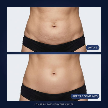 Crème Sculptante — Fermeté & Peau Lissée