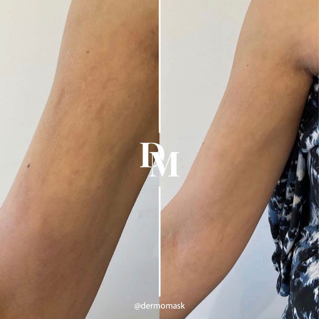 Selfie résultat client