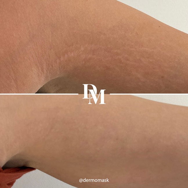 Selfie résultat client