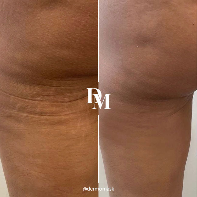 Selfie résultat client