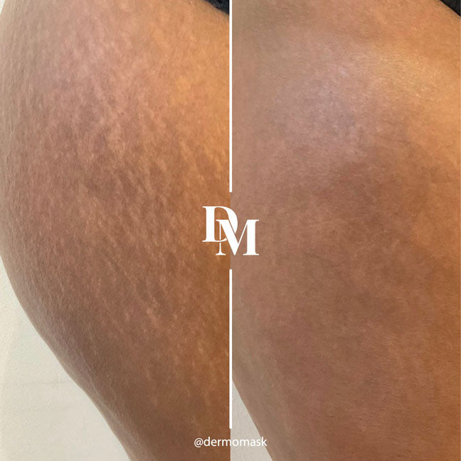 Selfie résultat client