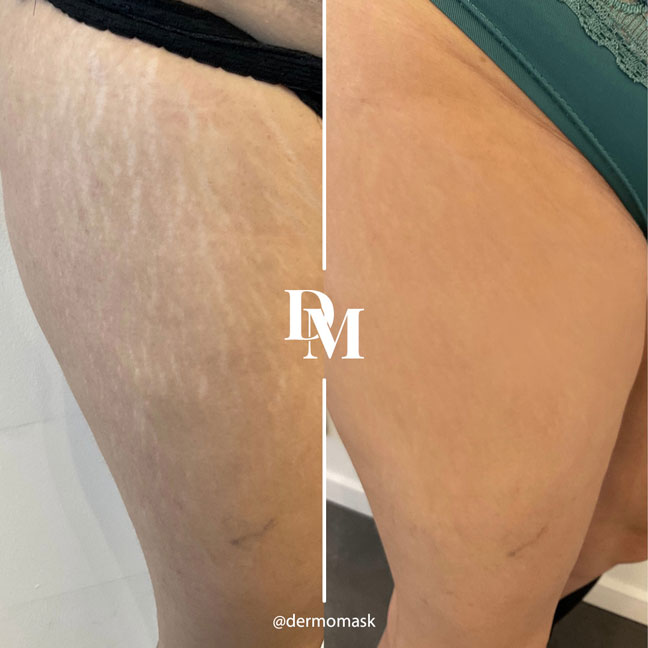 Selfie résultat client